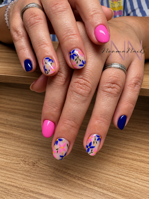 Remplissage au gel